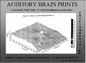 FIGURE 11: AUDITORY BRAIN PRINT